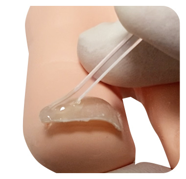 しっかり矯正で改善